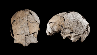 Buried for 5,300 years beneath a Stone Age tomb, a skull discovered in Spain has revealed the world’s earliest known ear surgery |