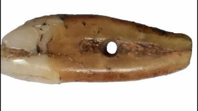 6,500 years ago, someone drilled a human tooth and wore it as a pendant; archaeologists found it sitting in a Serbian museum collection